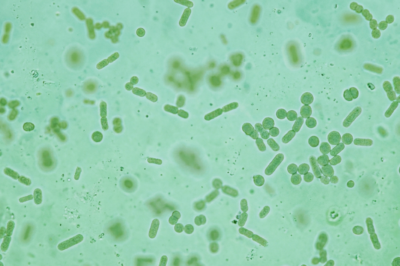 A Brief History of the Legislations on Biocidal Products in Turkey